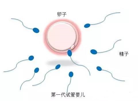 供卵试管服务